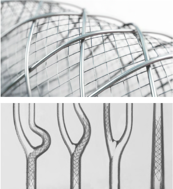 Practical Carotid Artery Stenting [ハードカバー] Carotid Angioplasty and Stenting – PB Cardiovascular